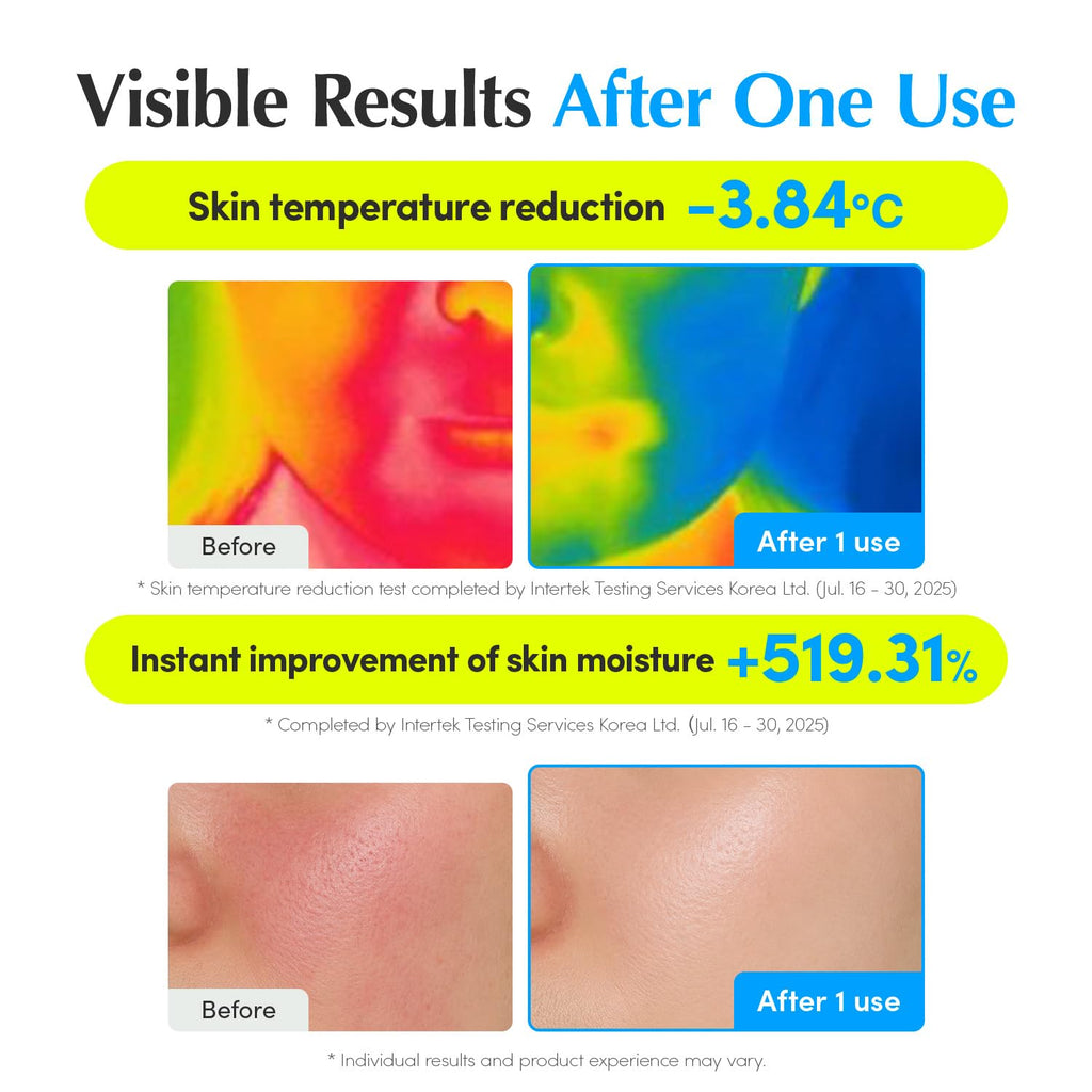 EQQUALBERRY Hyaltoin Flooding Smoothie Serum | 5% Hyaluronic Acid Serum for Face & Redness Relief | Deep Hydrating Cooling Care with 5 Ceramides & Ectoin | Korean Skincare (1.01oz / 30ml)